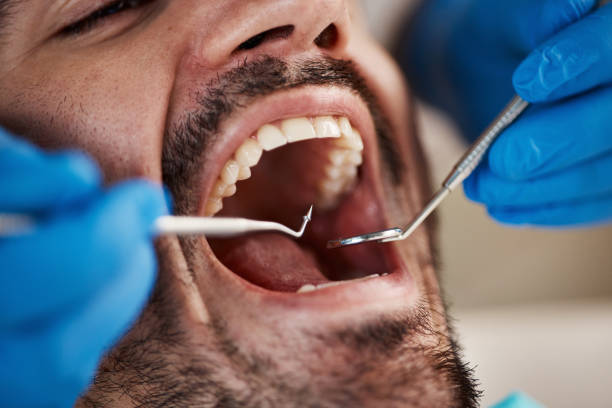 Best Urgent Care for Lost Fillings or Crowns in Old Jamestown, MO