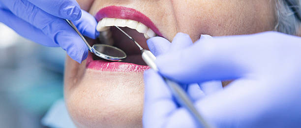 Reliable MO Emergency Dentist Solutions